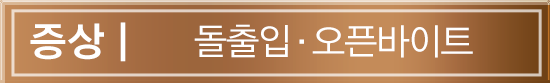 증상 | 돌출입 & 오픈바이트