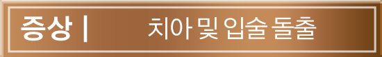 증상 | 치아 및 입술 돌출